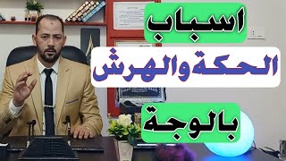 الحكة والهرش بالوجة سببة خطير سارع بالعلاج |اسباب الحكة والهرش بالوجة والشفايف والانف|الهرش فى الوجة