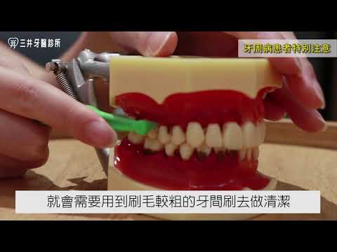 【牙助543】口腔衛教四部曲 第三部：牙間刷用法～關鍵是「選對尺寸」