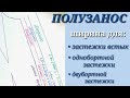 ПОЛУЗАНОС. Застежка в женской одежде.