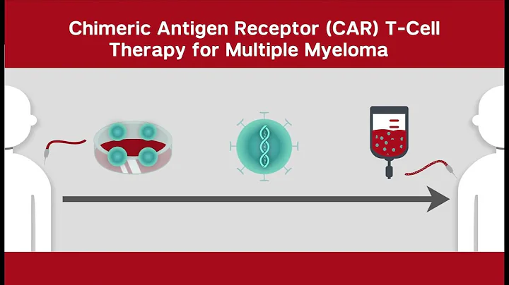 CAR T-Cell Therapy for Multiple Myeloma