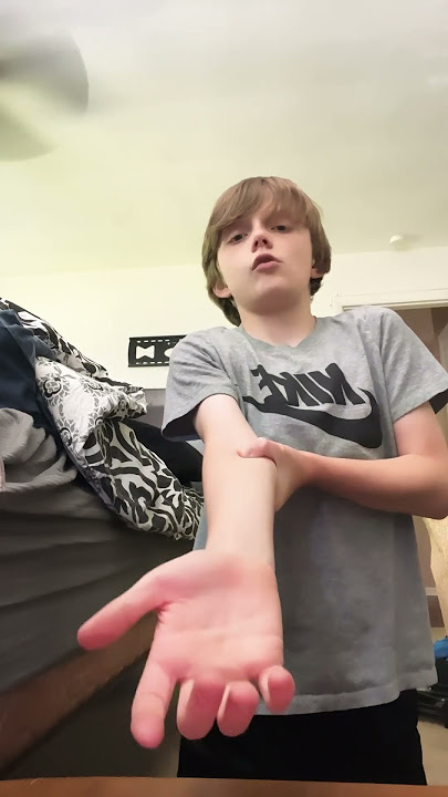 Tutorial on how to fake a broken arm #trendingshorts #trending