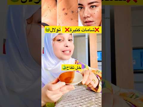 علاج تولال و شامات اكسبلور وصفات المغرب علاج علاج طبيعي تيك توك