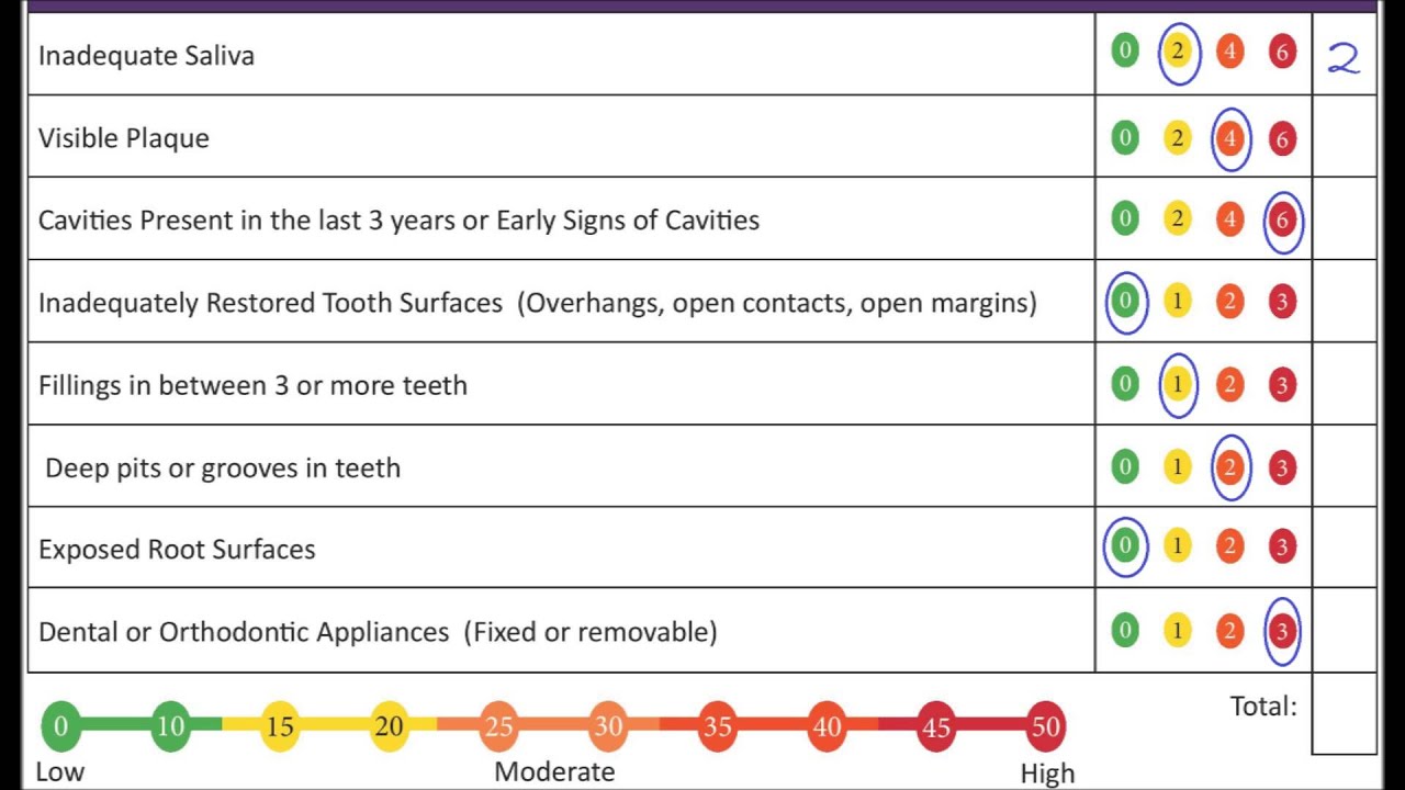 Cavity Risk Assessment Tutorial