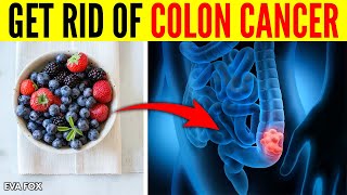 Eat This Every Day and Get Rid of Colon Cancer by Eva Fox 1,774 views 2 years ago 3 minutes, 31 seconds