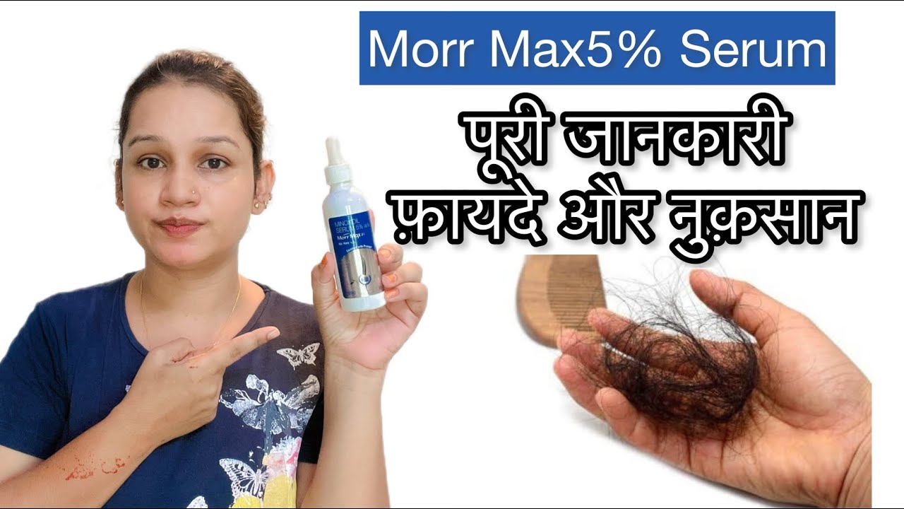 Morr Max 5% Serum Review |Hair fall control Hair Serum|Hair fall solution |