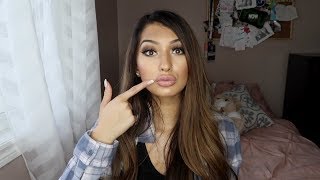 I got lip injections