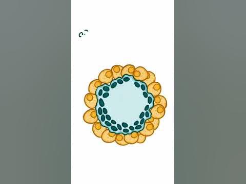 Саркоидоз (гранулёма, морфология, патанатомия) - YouTube