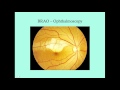 Retinal Vascular Disorders - CRASH! Medical Review Series