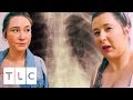 The Twins Whose Bodies Are Turning To Bone | Body Bizarre