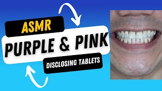 Thanks for 62M views on my 1st Disclosing Tablet ASMR! #shorts screenshot 3