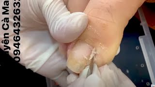 How to Repair Nails easy # 439 - Xuyen Nail