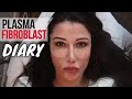 BEFORE & AFTER PLASMA FIBROBLAST DIARY:1 WEEK RESULTS (LORRY HILL)