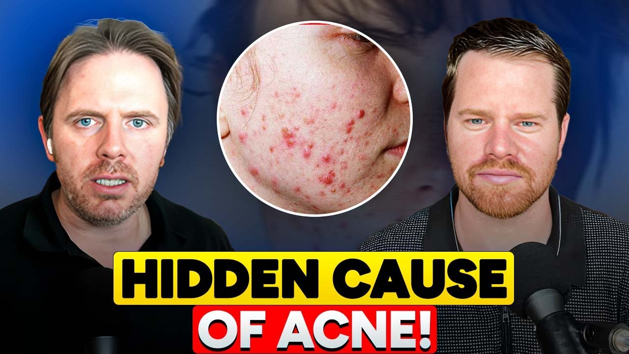 What Your Acne Reveals About Your Gut Health (Root Causes Explained ...