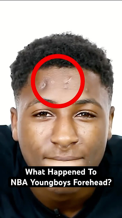 Download lagu What happened to NBA YoungBoy's forehead? 🤔