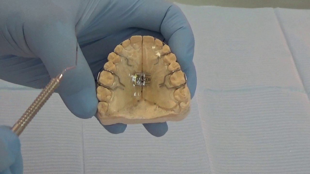 Placa de expansión transversal superior YouTube