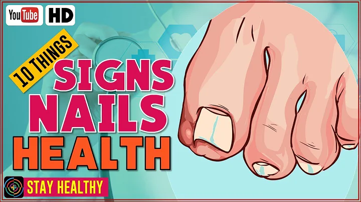 10 Things Your Nails Can Reveal About Your Health