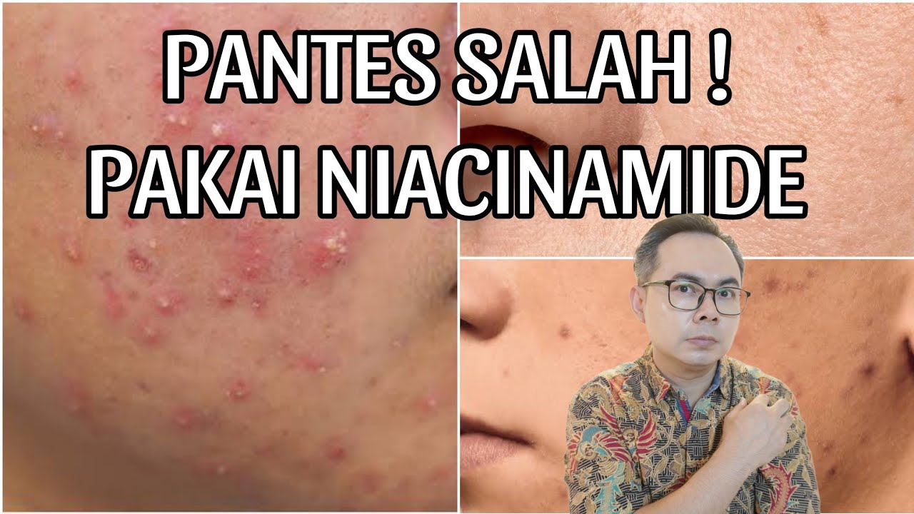 PANTAS KAMU SALAH MENGGUNAKAN SERUM NIACINAMIDE!