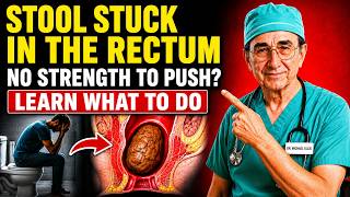 Feeling Stool Stuck in Your Rectum? Here’s What Your Body Is Trying to Tell You| Doctor Explains