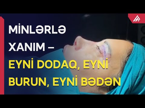 Plastik əməliyyat etdirən xanımlar niyə bir-birilərinə bənzəyirlər? – APA TV