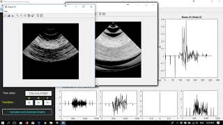 Ultrasound Simulation Application - MatLab screenshot 2