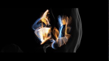 Short white matter fibres made visible