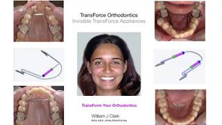 TransForce Orthodontics