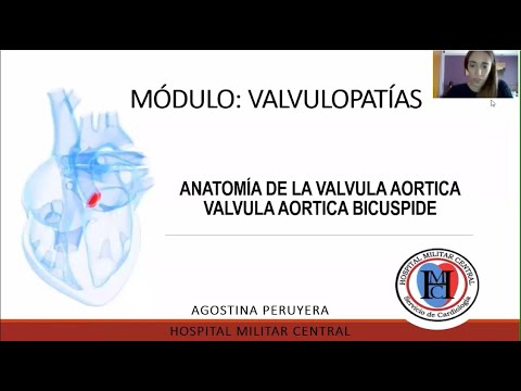 Anatomía valvula aortica   valvula aortica bicuspide - Módulo Valvulopatías
