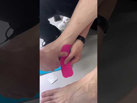 Using kinesiology tape