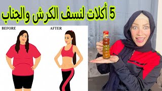 5 أكلات ذهبية للتخلص من دهون الكرش والاجناب نهائيا \تخسيس البطن بدون رجيم