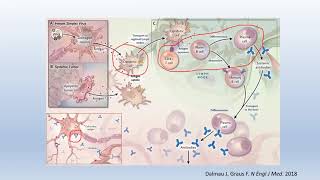 Neuroimmunology Nuggets: Anti-NDMA R Encephalitis