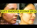 How to get soft smooth clear plump radiant skin  hla  mesolis