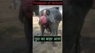 Prolapse of rectum l anal prolapse l dr Umar Khan