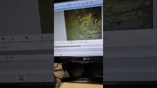 Imagens Obtidas Através De Um Microscópio Aumento De 1000 Vezes