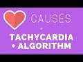 Causes of Tachycardia | Narrow and Wide Complex Tachycardia Algorithm