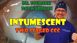 Two staged CCC for intumescent cataract Dr Sourabh Patwardhan
