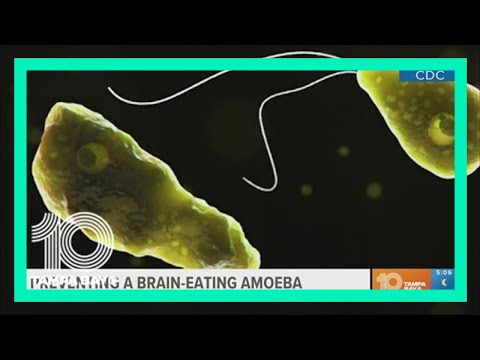 How to avoid brain-eating amoeba while swimming this summer
