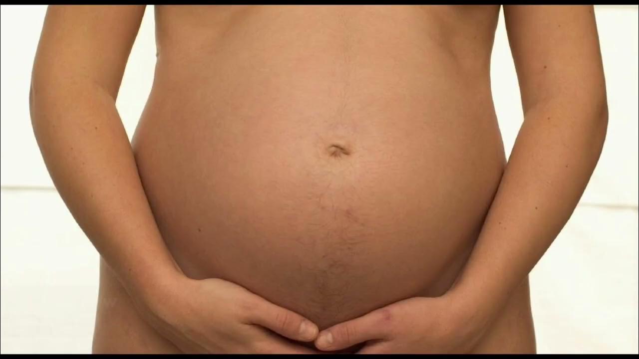 абдоминопластика серома. шлифовка шрама после кс. почему после кесарева живот. ретроградная абдоминопластика. живот после кесарево через месяц.