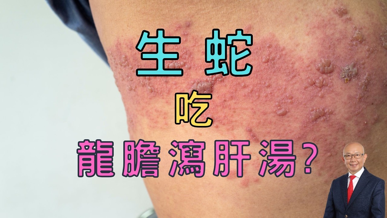 生蛇吃龍膽瀉肝湯?