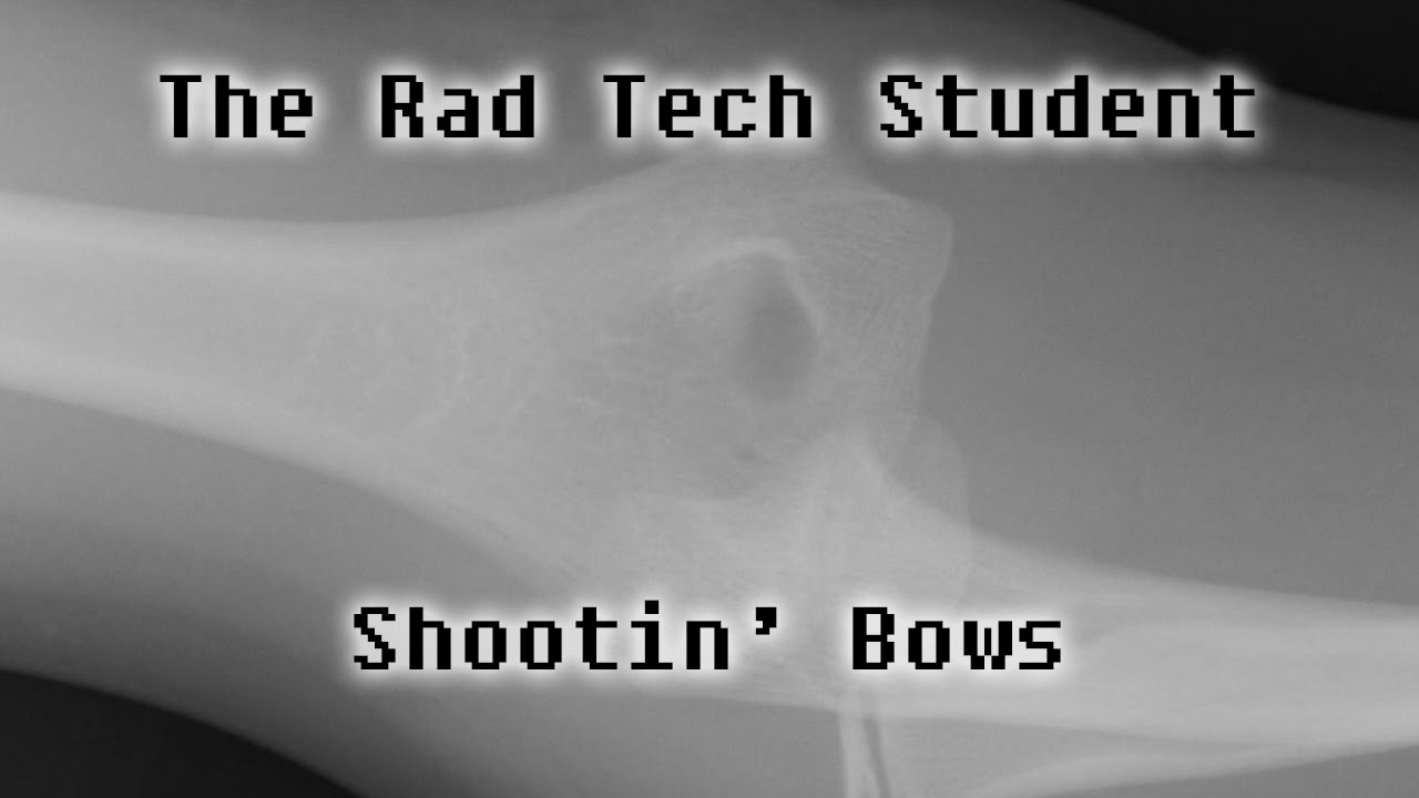 The Rad Tech Student Elbow X-Ray Song: SHOOTIN BOWS! - YouTube