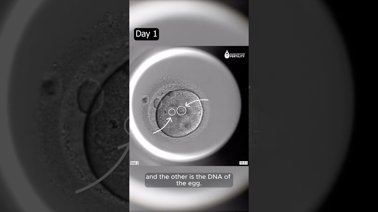 Watch an embryo develop over 5 days after ICSI treatment ????