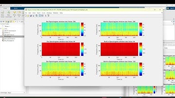 EEG Spectrogram STFT MATLAB
