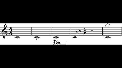 Duration (music) | Wikipedia audio article