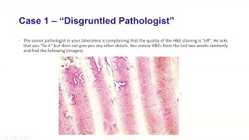 Process Control – Quantitative and Qualitative Quality Control (Advanced Case Review)