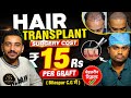 Best Hair Transplant Surgery Bilaspur  Chhattisgarh me / Safe and Secure Clinic 