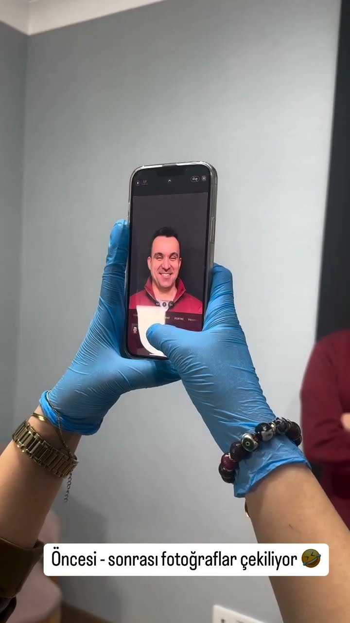 Öncesi - sonrası fotoğraflar çekiliyor ?