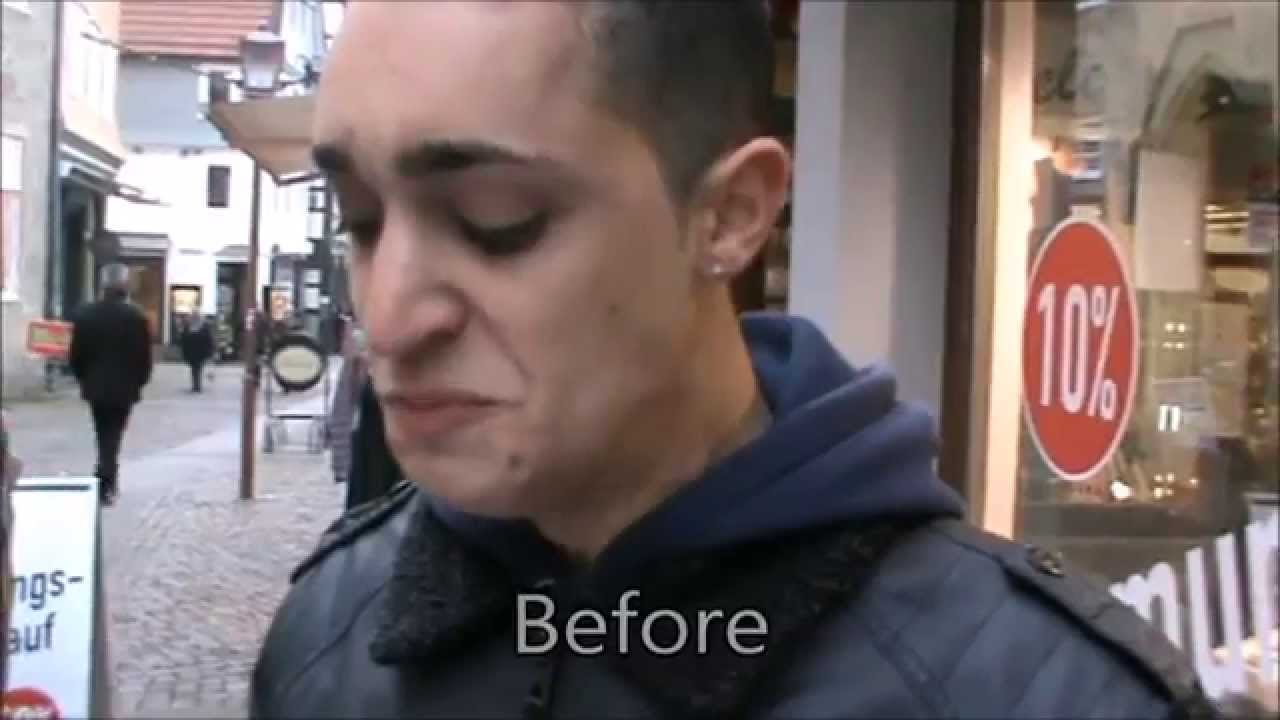 Me overcoming my stutter - Before & After