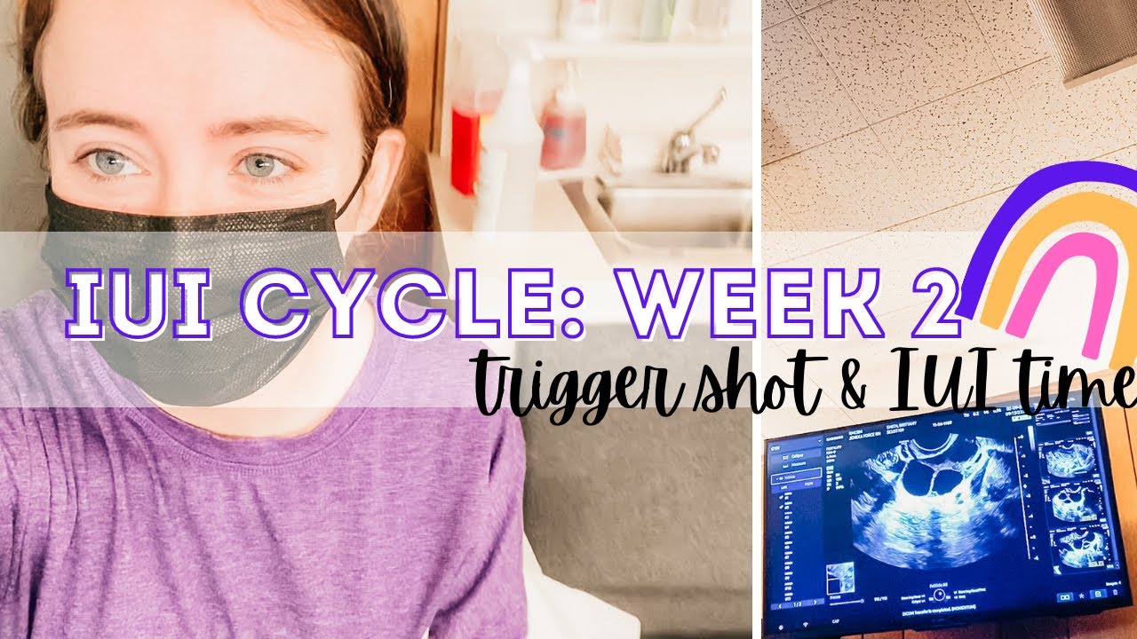IUI TIME || FIRST IUI CYCLE || MENOPUR INJECTION & TRIGGER SHOT ...