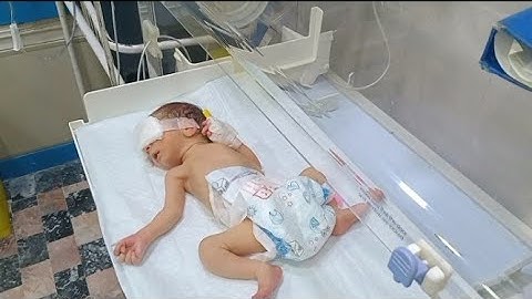 Jaundiced Neonate Receiving Phototherapy & Feeding in Incubator | NICU Care.