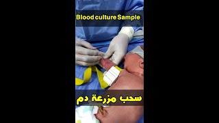 Expert Tips for Successful Newborn Blood Culture Samples - سحب عينة مزرعة دم لطفل حديثى الولادة