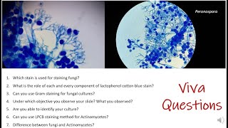 All about Lactophenol cotton blue Staining | LPCB | Viva questions | MSc practical series | Fungi